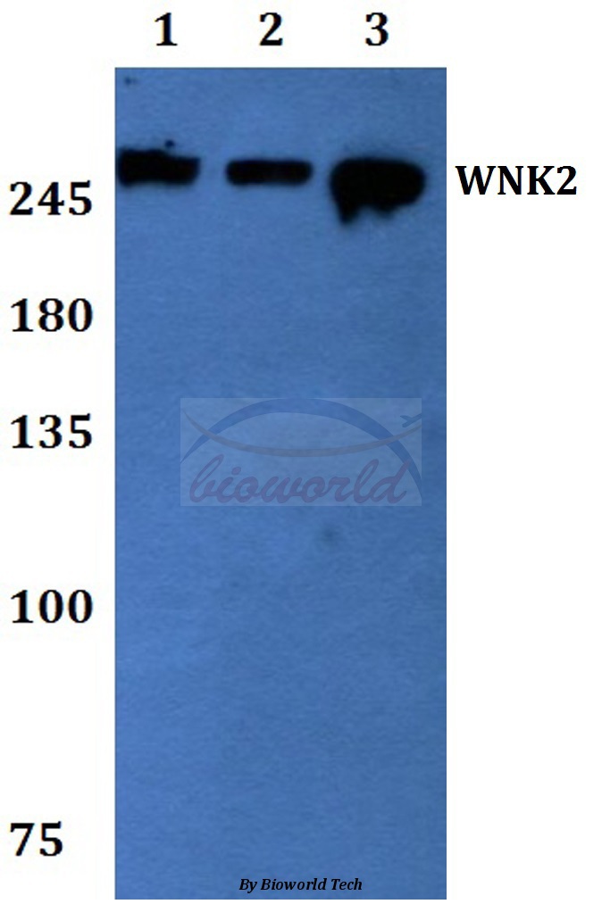 Anti-WNK2 Antibody