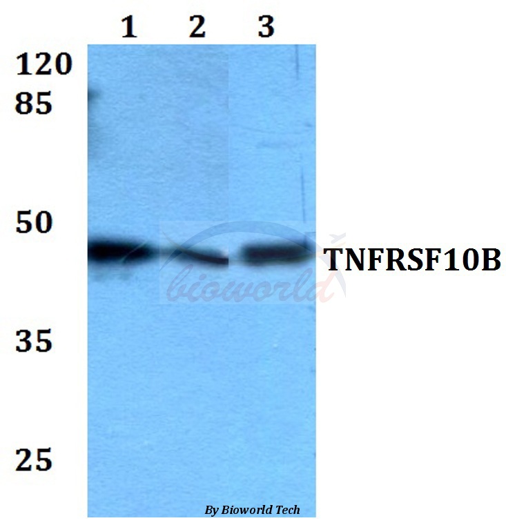 Anti-TNFRSF10B Antibody