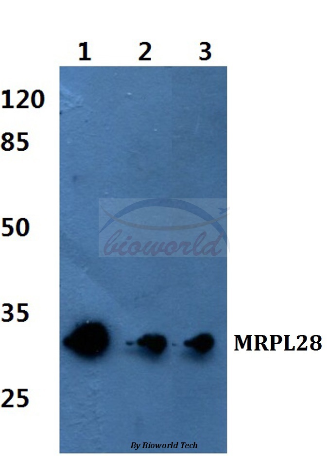 Anti-MRP-L28 Antibody