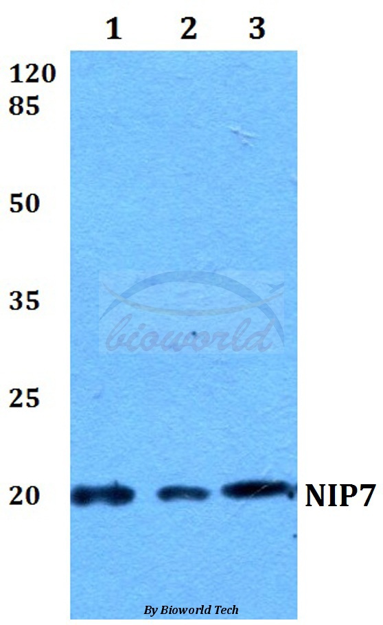 Anti-NIP7 Antibody