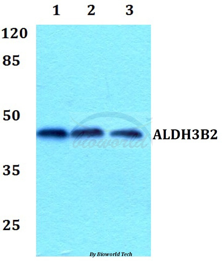 Anti-ALDH3B2 Antibody