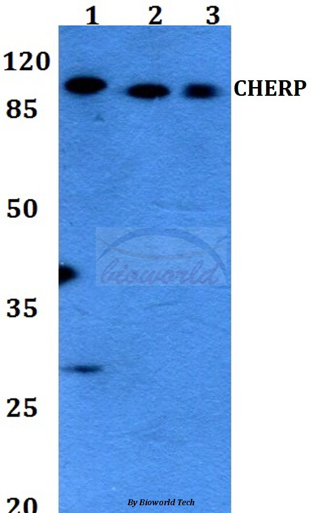 Anti-CHERP Antibody