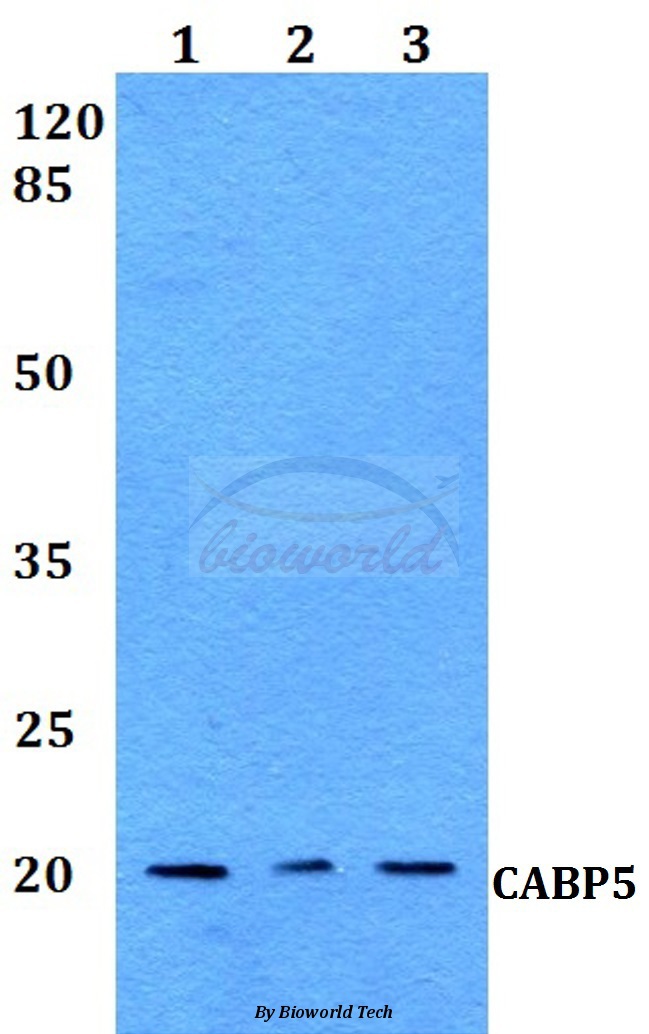 Anti-CABP5 Antibody