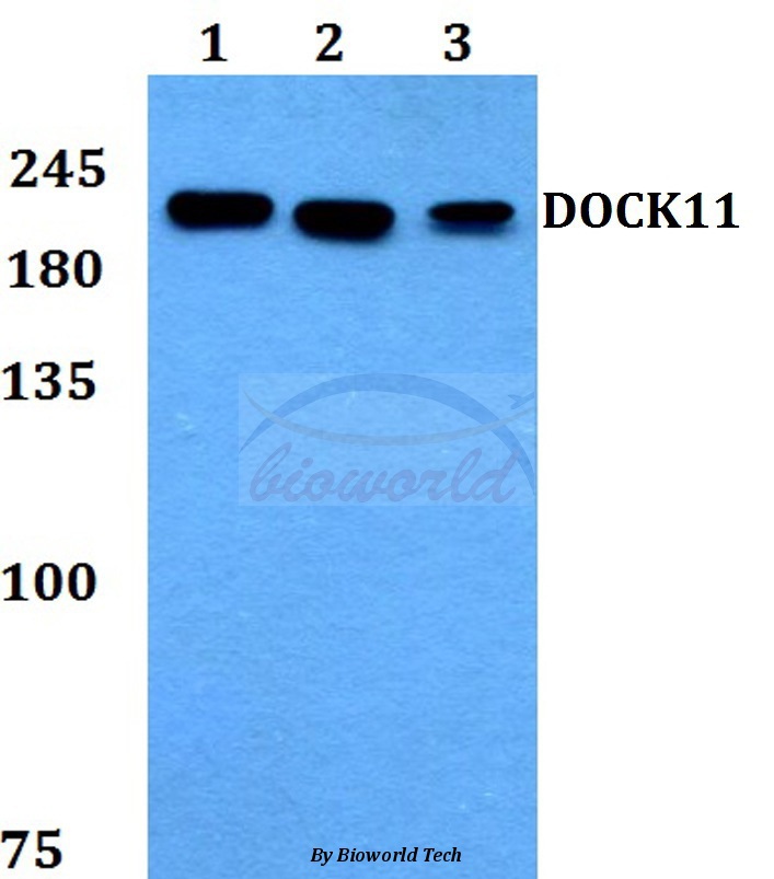 Anti-DOCK11 Antibody