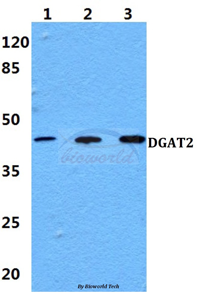 Anti-DGAT2 Antibody
