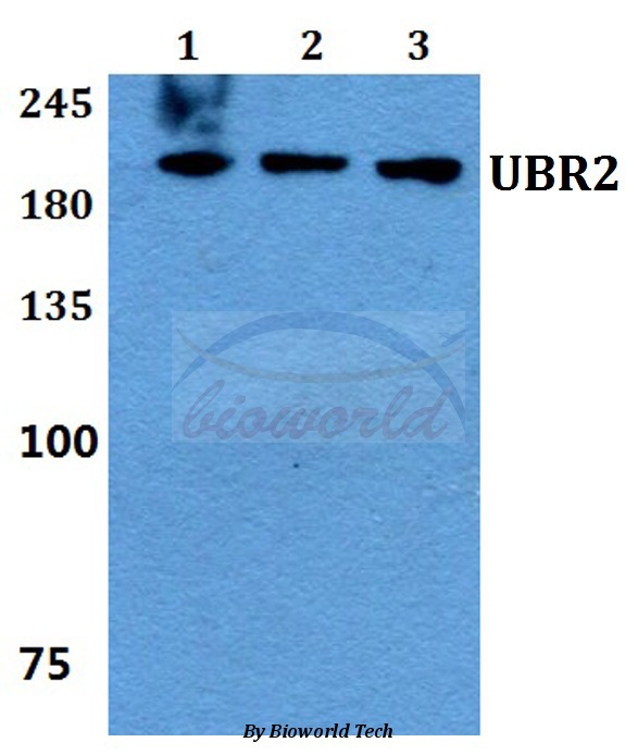 Anti-UBR2 Antibody