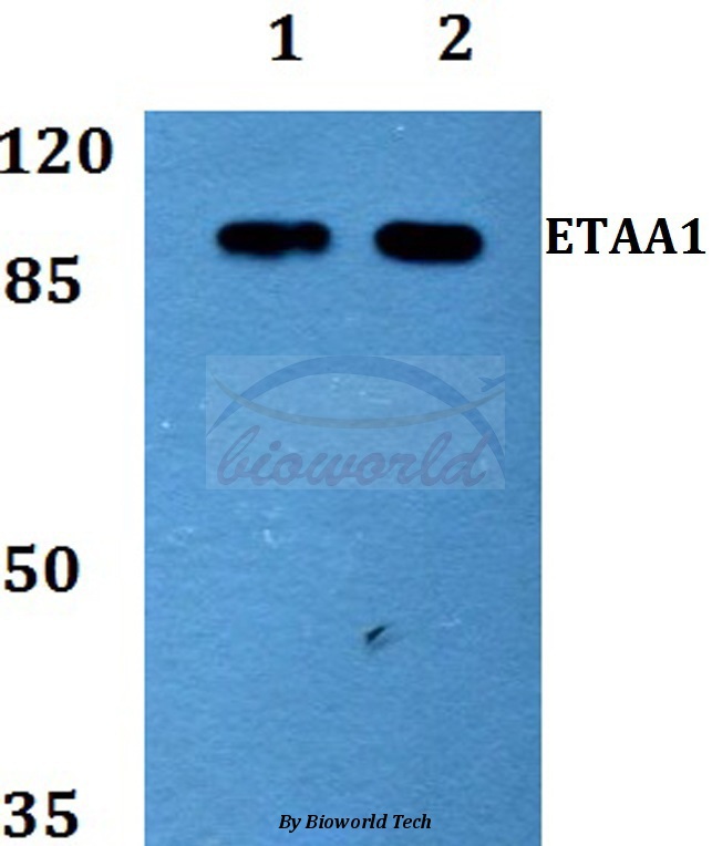 Anti-ETAA1 Antibody