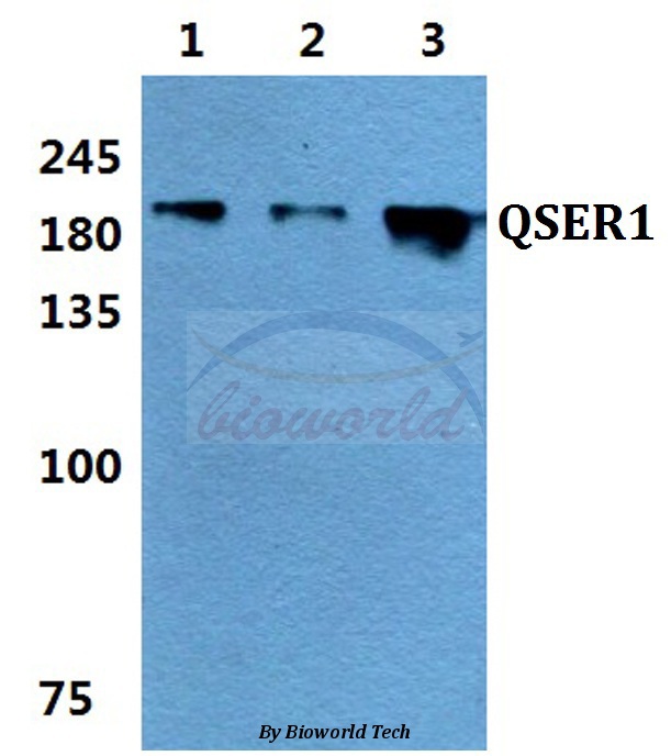Anti-QSER1 Antibody