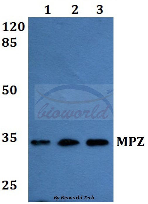 Anti-MPZ Antibody