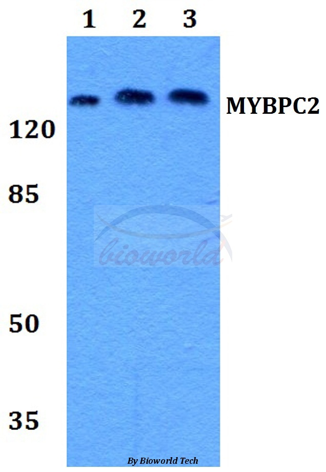Anti-MYBPC2 Antibody