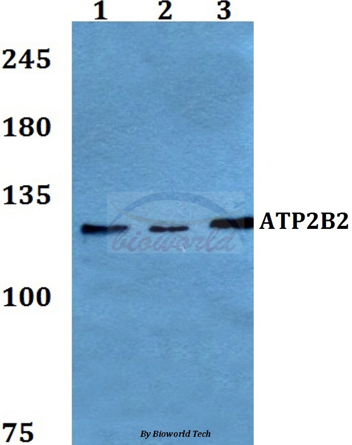 Anti-ATP2B2 Antibody