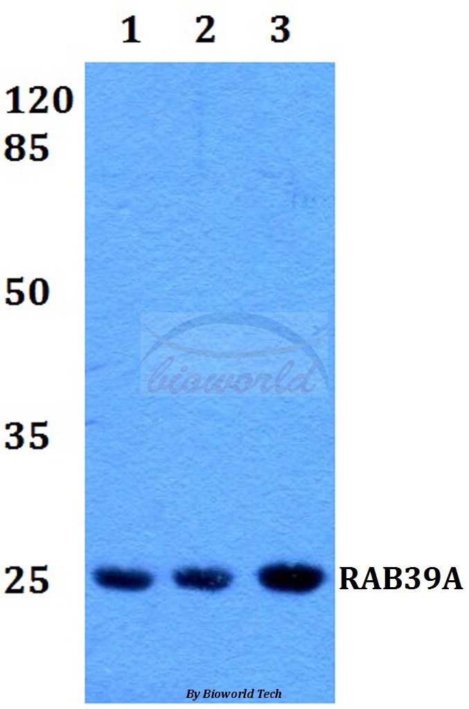 Anti-RAB39 Antibody