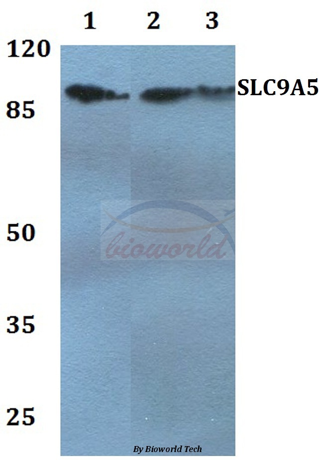 Anti-SLC9A5 Antibody