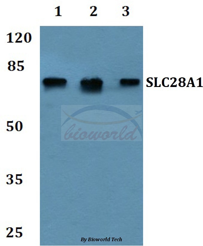 Anti-SLC28A1 Antibody