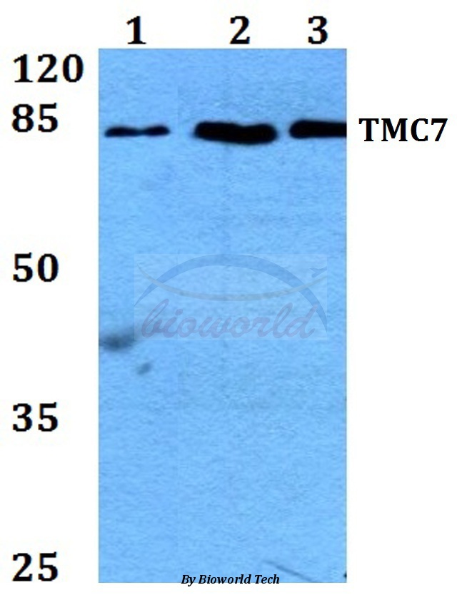 Anti-TMC7 Antibody