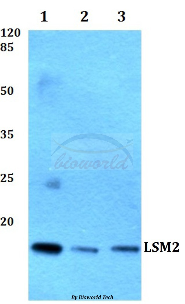 Anti-LSM2 Antibody