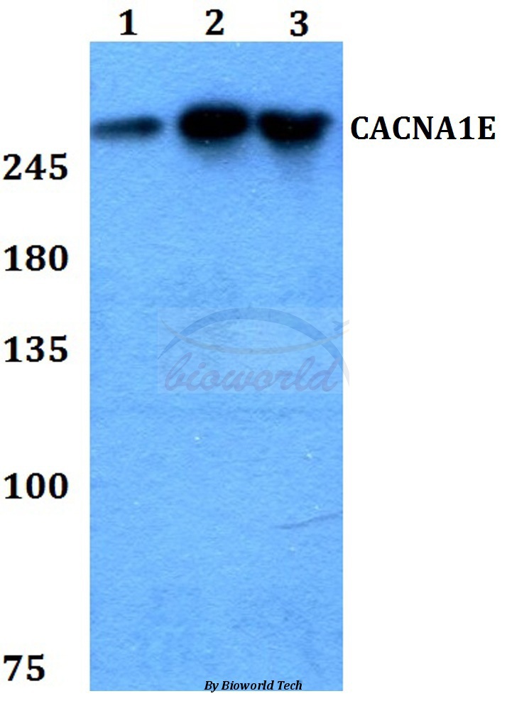 Anti-CACNA1E Antibody