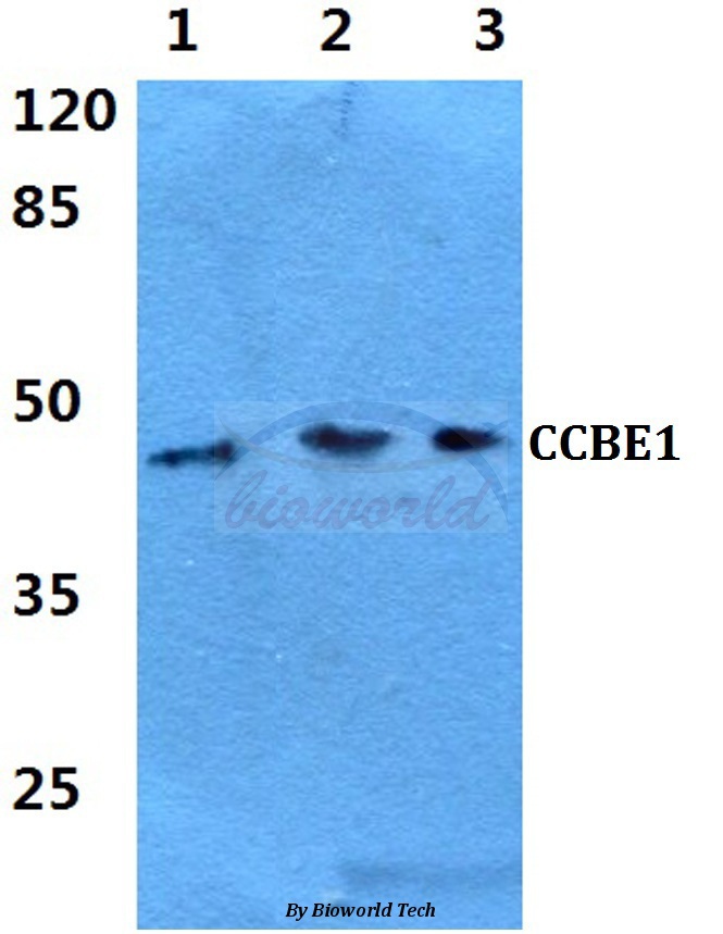 Anti-CCBE1 Antibody