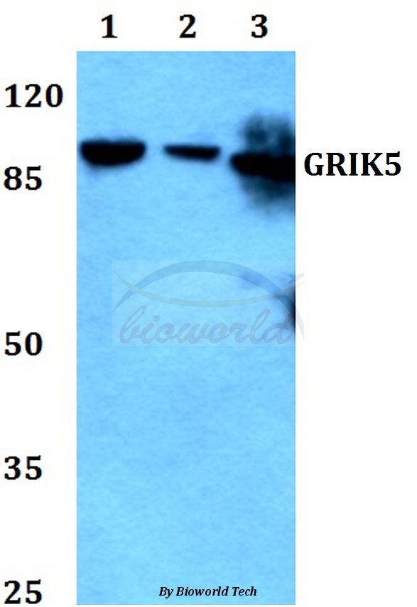 Anti-GRIK5 Antibody