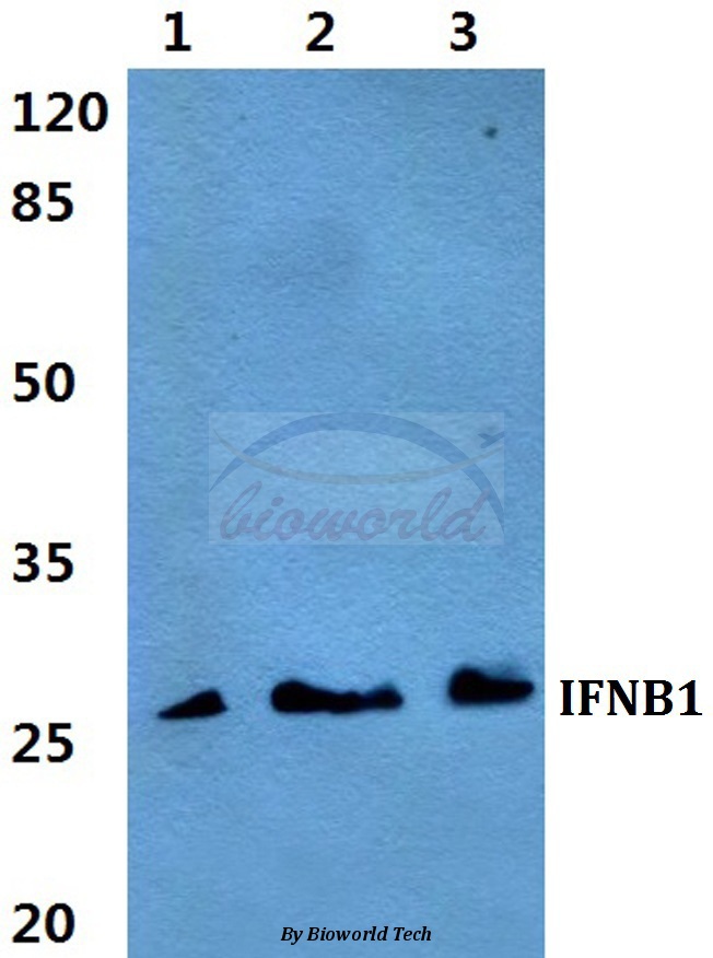Anti-IFNB1 Antibody