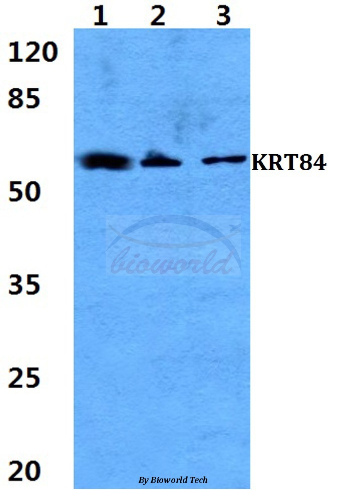 Anti-Cytokeratin 84 Antibody