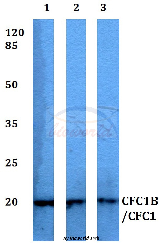 Anti-CFC1B/CFC1 Antibody