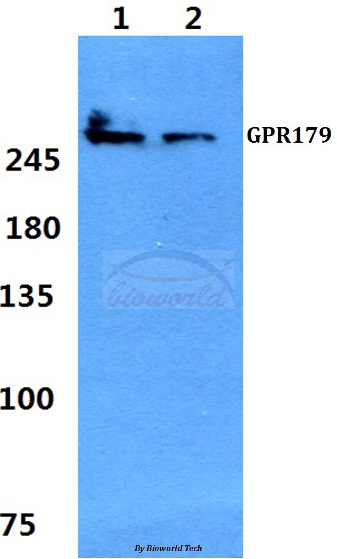 Anti-GPR179 Antibody