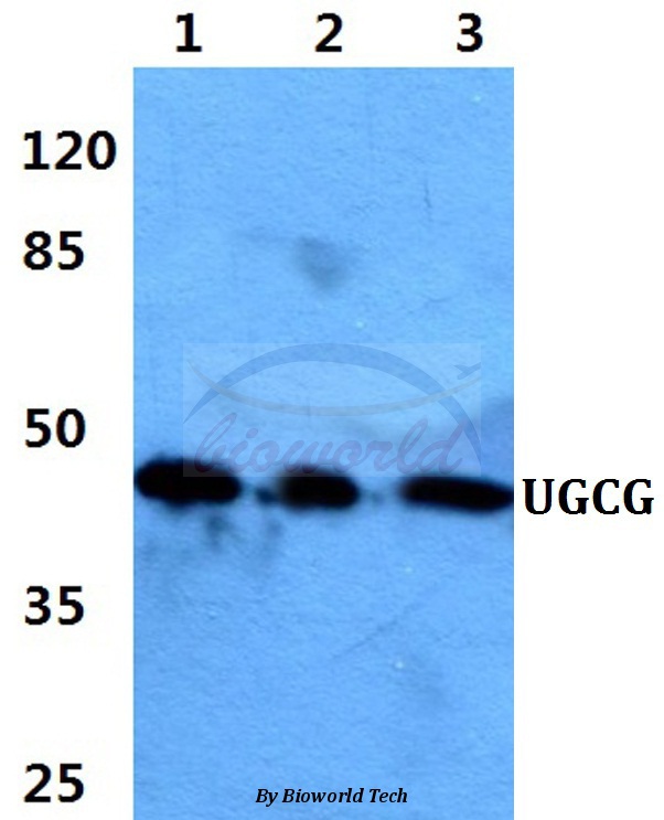 Anti-UGCG Antibody
