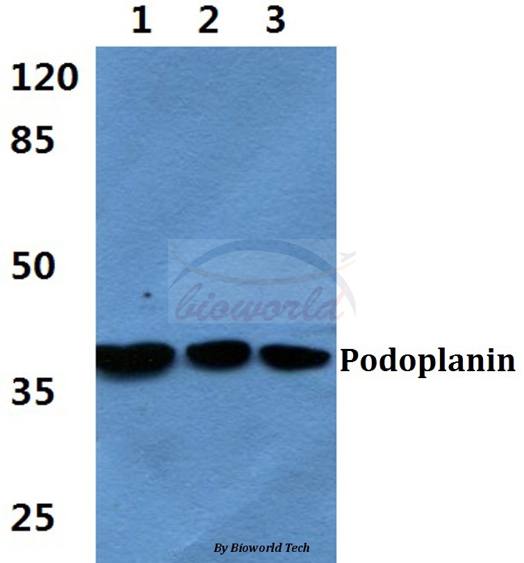 Anti-Podoplanin Antibody