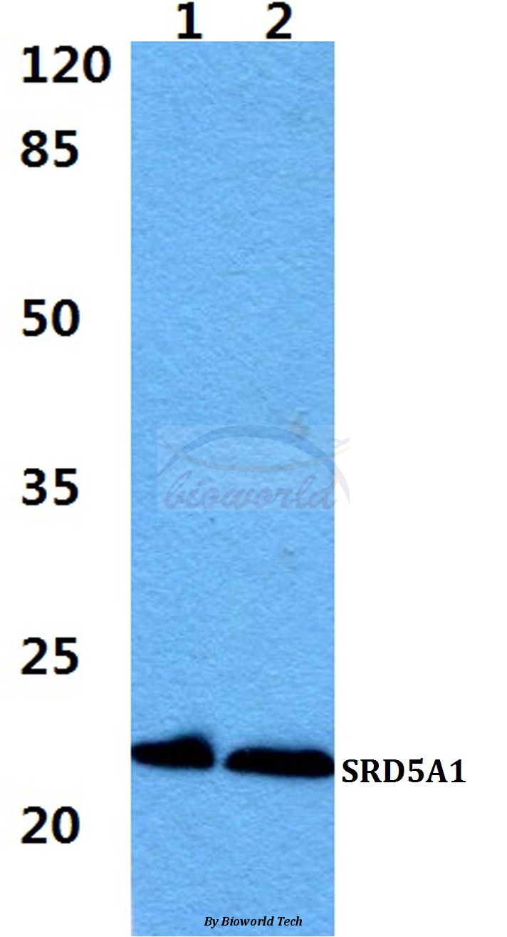 Anti-SRD5A1 Antibody