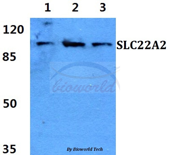 Anti-SLC22A2 Antibody