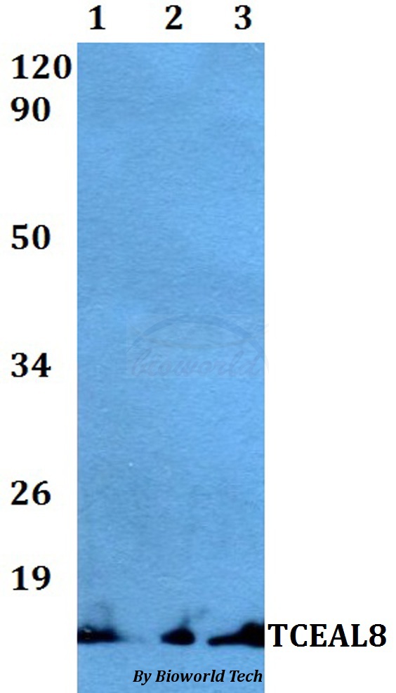 Anti-TCEAL8 Antibody