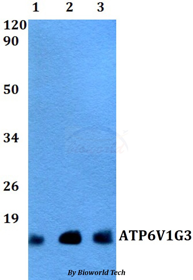 Anti-ATP6V1G3 Antibody
