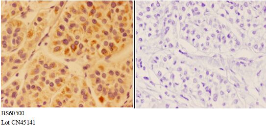 Anti-APOC4 Antibody Anti-APOC4 Antibody
