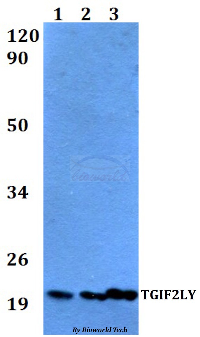 Anti-TGIF2LY Antibody