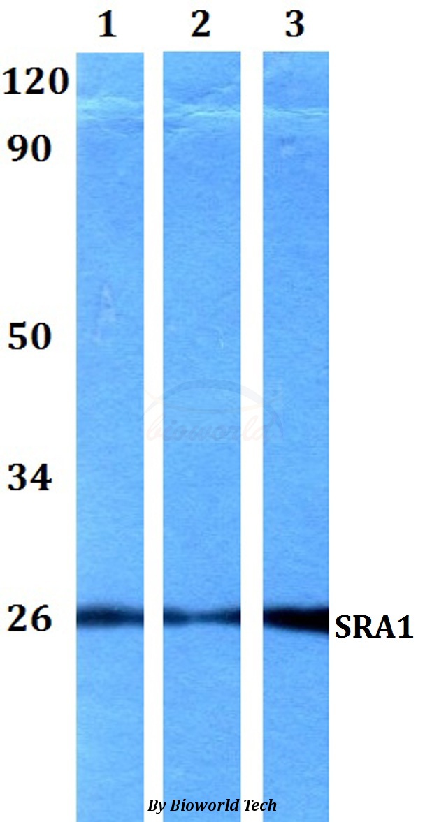 Anti-SRA1 Antibody