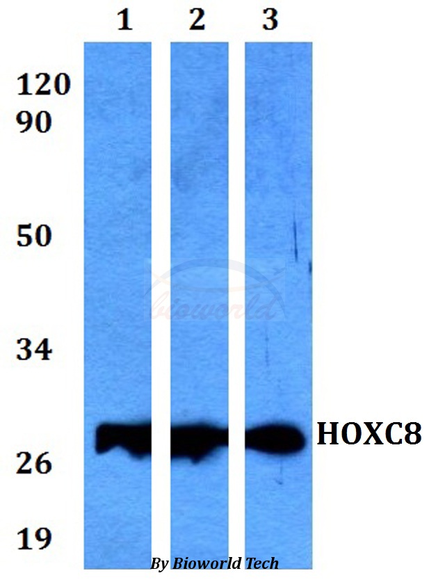 Anti-HOXC8 Antibody