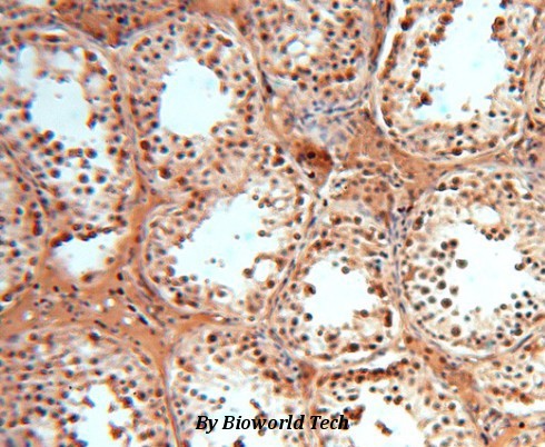 Anti-SOD1 Antibody Anti-SOD1 Antibody