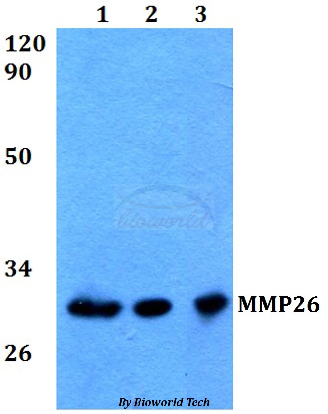 Anti-MMP26 Antibody