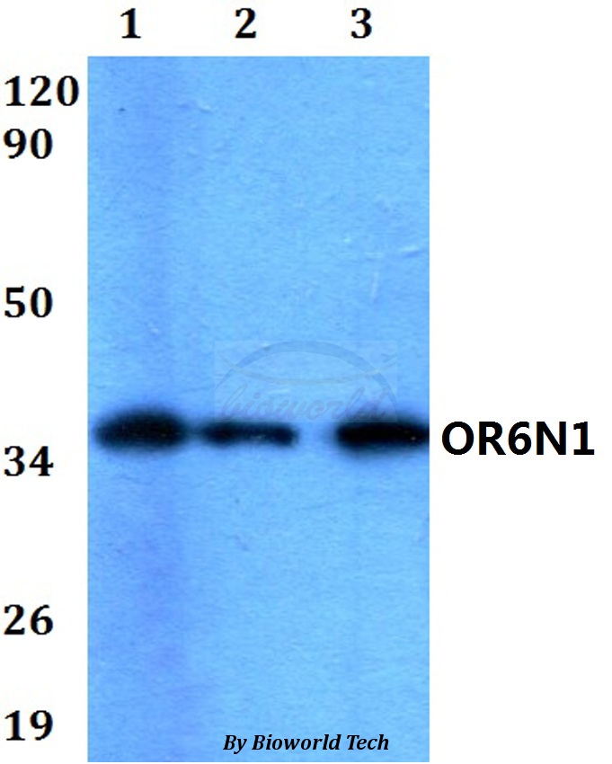Anti-OR6N1 Antibody