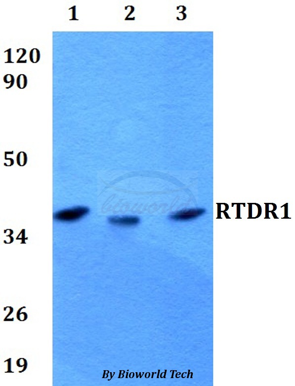 Anti-RTDR1 Antibody