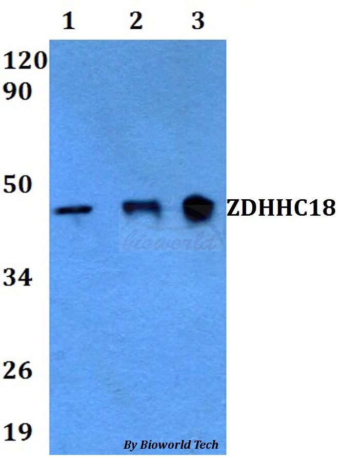 Anti-ZDHHC18 Antibody