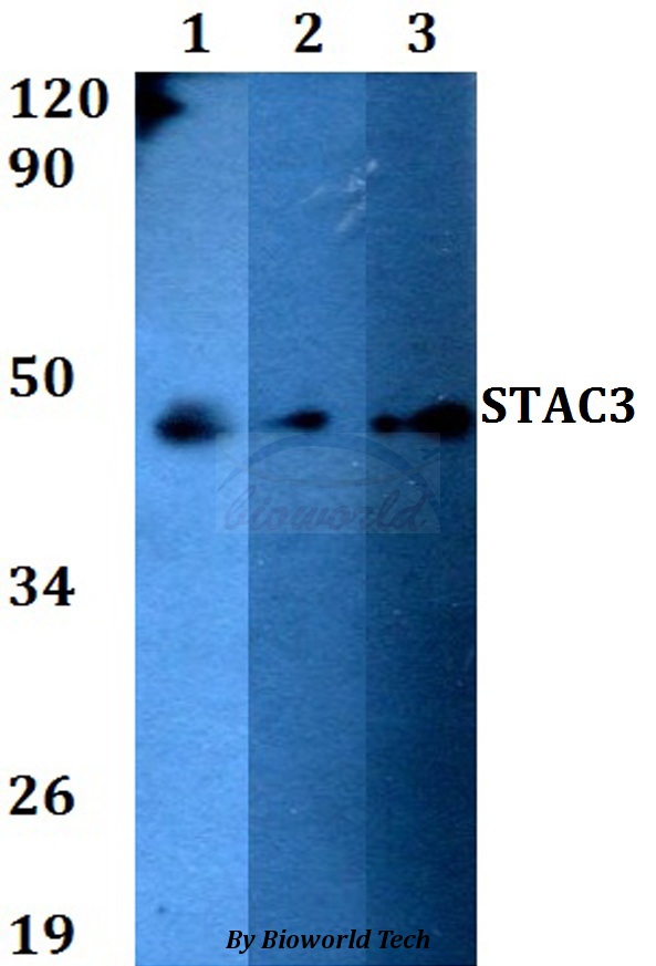 Anti-STAC3 Antibody