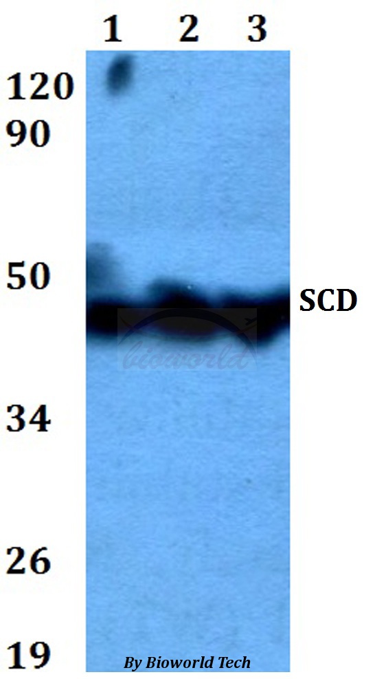 Anti-SCD Antibody