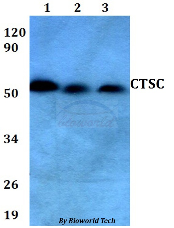 Anti-CTSC Antibody