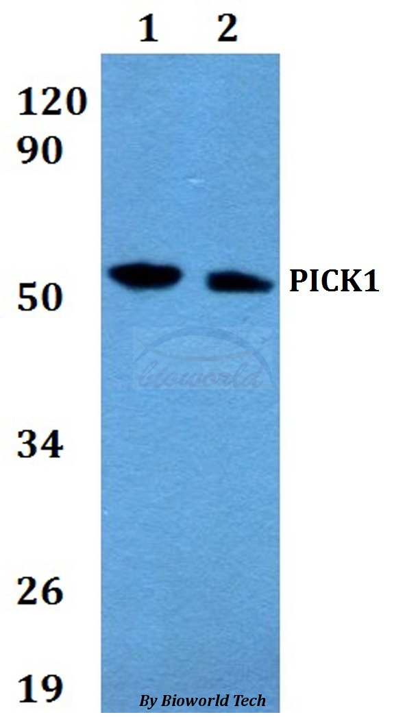 Anti-PICK1 Antibody