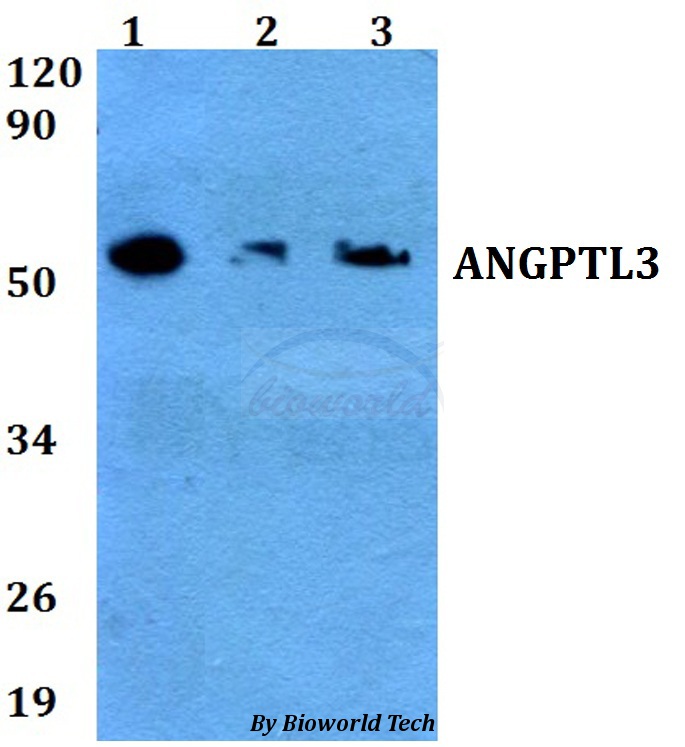 Anti-ANGPTL3 Antibody
