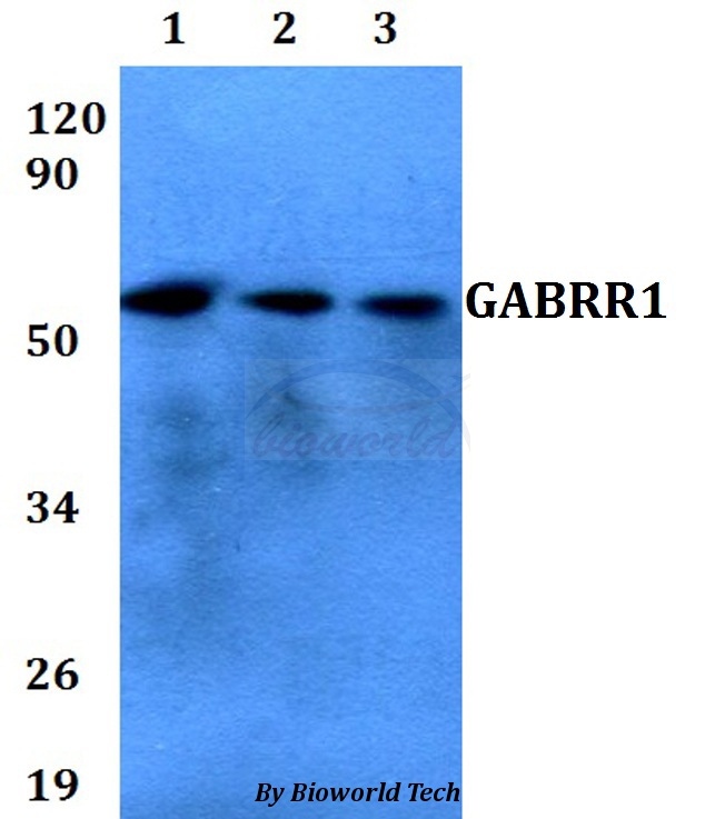 Anti-GABRR1 Antibody
