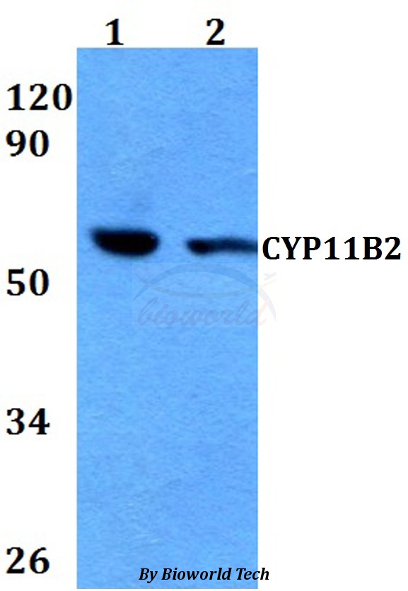 Anti-CYP11B2 Antibody