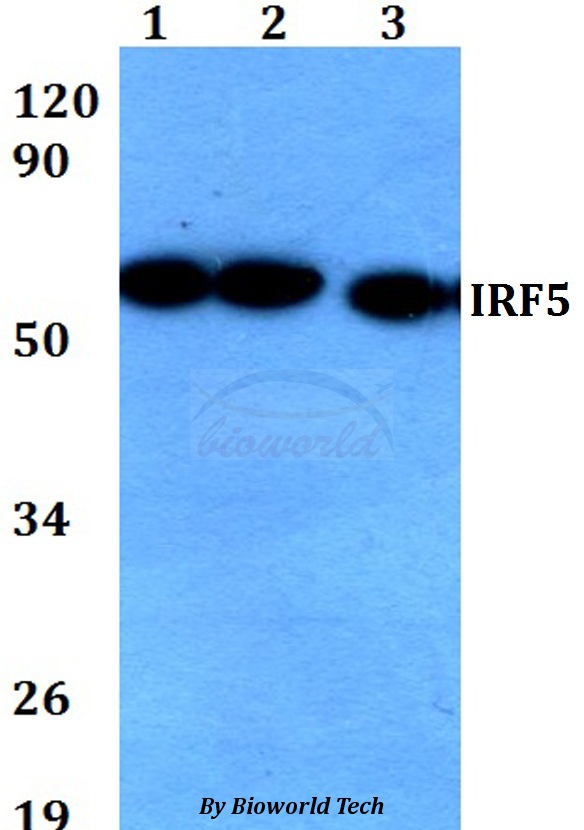 Anti-IRF5 Antibody